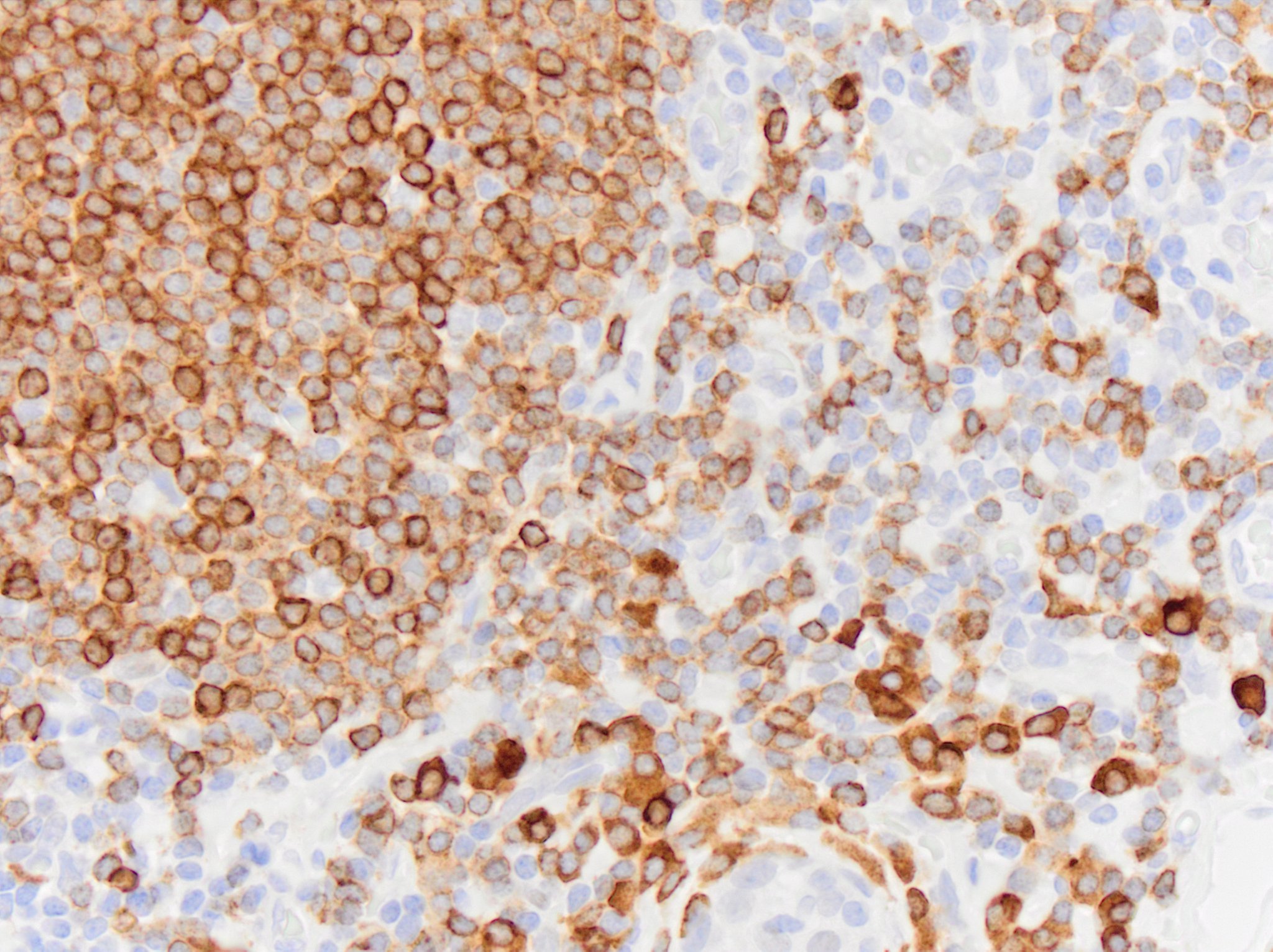 CD79A Antibody (HM57) - BSA Free NB100-64347